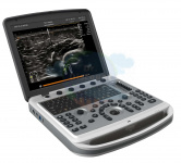 УЗИ аппарат CHISON SonoBook 6